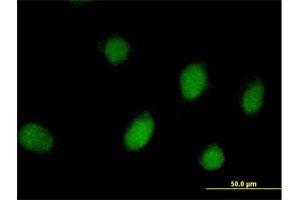 Immunofluorescence of purified MaxPab antibody to PEPP-2 on HeLa cell. (RHOXF2 Antikörper  (AA 1-288))
