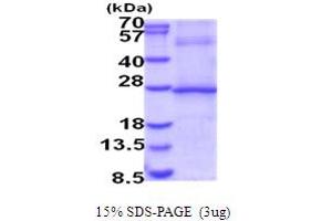 SDS-PAGE (SDS) image for Interleukin 29 (IL29) (AA 20-200) protein (His tag) (ABIN5854065) (IL29 Protein (AA 20-200) (His tag))