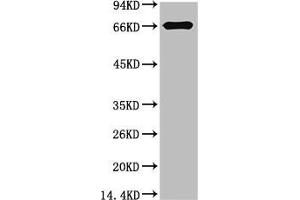 Western blot analysis of Bovine Serum Albumin using Bovine Serum Albumin Monoclonal Antibody. (BSA Antikörper)