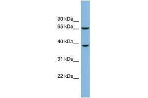 WB Suggested Anti-RLBP1L1 Antibody Titration: 0. (Clavesin 1 Antikörper  (Middle Region))