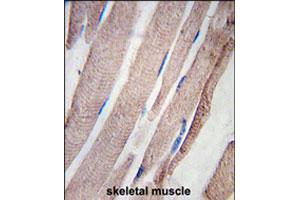 Formalin-fixed and paraffin-embedded human skeletal muscle tissue reacted with PHPT1 polyclonal antibody  , which was peroxidase-conjugated to the secondary antibody, followed by DAB staining. (PHPT1 Antikörper  (N-Term))
