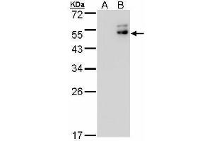 WB Image Western Blot analysis of DPF2 expression in transfected 293T cell line by DPF2 polyclonal antibody. (DPF2 Antikörper  (Center))