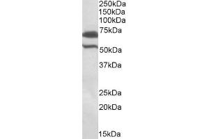 ABIN571243 (1µg/ml) staining of Rat Testis lysate (35µg protein in RIPA buffer). (BIRC3 Antikörper  (Internal Region))