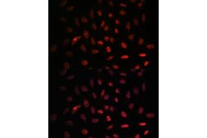 Immunofluorescence (IF) image for anti-Nuclear Transport Factor 2-Like Export Factor 2 (NXT2) (AA 110-180) antibody (ABIN6144977)