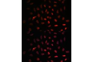 Immunofluorescence analysis of U-2 OS cells using NXT2 antibody (ABIN6133260, ABIN6144977, ABIN6144978 and ABIN6217951) at dilution of 1:100. (NXT2 Antikörper  (AA 110-180))