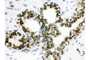 Anti- Lamin B1 Picoband antibody, IHC(P) IHC(P): Human Mammary Cancer Tissue
