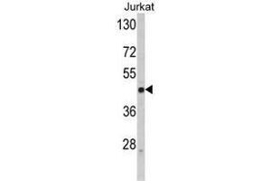 Western blot analysis of SELL Antibody (C-term) in Jurkat cell line lysates (35ug/lane). (L-Selectin Antikörper  (C-Term))