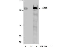 Immunoprecipitation (IP) image for anti-Mechanistic Target of Rapamycin (serine/threonine Kinase) (mTOR) (C-Term) antibody (ABIN2855088)