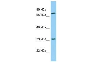 WB Suggested Anti-KLK2 Antibody Titration:  0. (Kallikrein 2 Antikörper  (Middle Region))