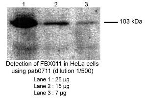 Image no. 1 for anti-F-Box Protein 11 (FBXO11) (Internal Region) antibody (ABIN559708)