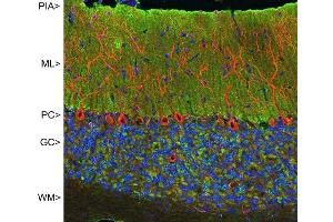 Confocal image of adult rat cerebellar cortex stained with MCA- 2D11 (green), chicken polyclonal antibody to MAP2 CPCA-MAP2 (red) and DNA (blue). (VSNL1 Antikörper)