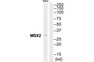 Western Blotting (WB) image for anti-Msh Momeobox 2 (Msx2) (Internal Region) antibody (ABIN1851456) (Msx2/Hox8 Antikörper  (Internal Region))