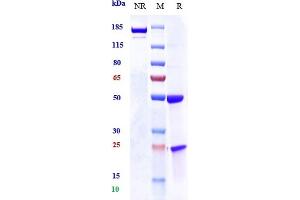 Anti-Osteopontin Reference Antibody (ASK8007) on SDS-PAGE under reducing (R) condition.