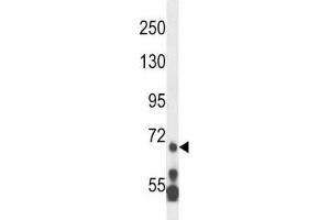 Western Blotting (WB) image for anti-Myeloid/lymphoid Or Mixed-Lineage Leukemia 5 (Trithorax Homolog) (MLL5) (AA 93-120) antibody (ABIN3031896)