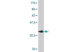Western Blotting (WB) image for anti-Huntingtin Interacting Protein 1 Related (HIP1R) (AA 969-1066) antibody (ABIN563912)