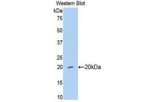Western Blotting (WB) image for anti-Matrix Metallopeptidase 13 (Collagenase 3) (MMP13) (AA 62-217) antibody (ABIN1172288) (MMP13 Antikörper  (AA 62-217))