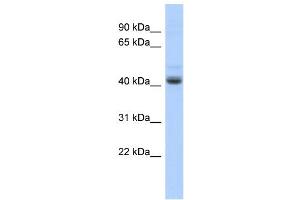 WB Suggested Anti-PKNOX1 Antibody Titration:  0. (PKNOX1 Antikörper  (Middle Region))