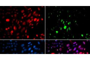 Immunofluorescence analysis of U2OS cells using Phospho-ABL1(Y204) Polyclonal Antibody (ABL1 Antikörper  (pTyr204))