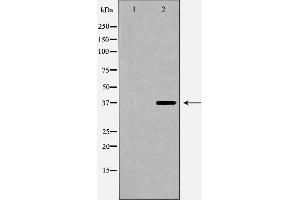 Western blot analysis of extracts of HepG2 , using CFHR1 antibody. (CFHR1 Antikörper  (C-Term))