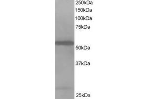 ABIN184747 staining (1µg/ml) of Jurkat lysate (RIPA buffer, 35µg total protein per lane). (DBNL Antikörper  (N-Term))