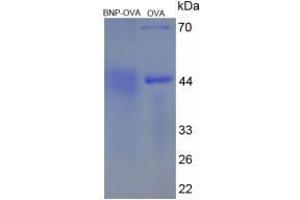 Image no. 3 for Brain Natriuretic Peptide (BNP) protein (Ovalbumin) (ABIN2127342) (BNP Protein (Ovalbumin))