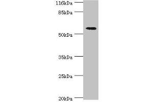 Western blot All lanes: ACBD5 antibody at 2 μg/mL + Hela whole cell lysate Secondary Goat polyclonal to rabbit IgG at 1/10000 dilution Predicted band size: 61, 55, 59, 47 kDa Observed band size: 61 kDa