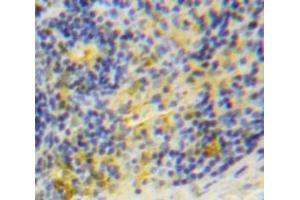 Used in DAB staining on fromalin fixed paraffin-embedded Spleen tissue (TRAF1 Antikörper  (AA 169-392))