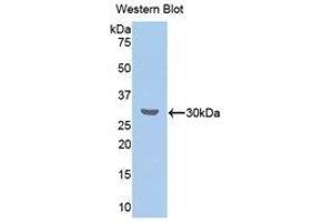 Western Blotting (WB) image for anti-Cholesteryl Ester Transfer Protein (CETP) (AA 232-487) antibody (ABIN1858369)