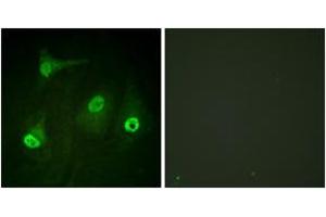 Immunofluorescence analysis of HeLa cells, using NF-kappaB p65 (Acetyl-Lys310) Antibody. (NF-kB p65 Antikörper  (acLys310))