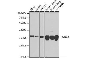 Western blot analysis of extracts of various cell lines using GNB2 Polyclonal Antibody at dilution of 1:1000. (GNB2 Antikörper)