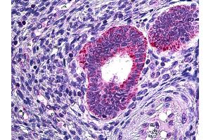 Anti-PLA2G4A antibody IHC of human uterus. (PLA2G4A Antikörper  (AA 153-166))