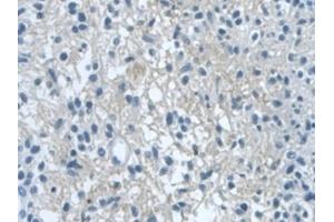 Immunohistochemistry (IHC) image for anti-Dishevelled Segment Polarity Protein 1 (DVL1) (AA 150-285) antibody (ABIN7439894)