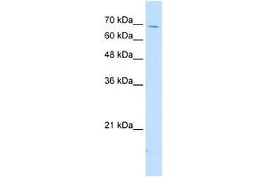 WB Suggested Anti-IL18RAP Antibody Titration:  2. (IL18RAP Antikörper  (N-Term))