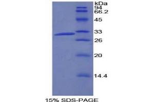 SDS-PAGE analysis of Rat PIK3C2b Protein. (Phosphatidylinositol-4-Phosphate 3-Kinase, Catalytic Subunit Type 2 beta (PIK3C2B) Peptid)