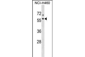 DNAJA4 Antibody (C-term) (ABIN1536998 and ABIN2849123) western blot analysis in NCI- cell line lysates (35 μg/lane). (DNAJA4 Antikörper  (C-Term))