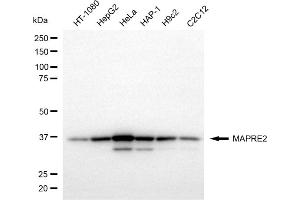 Western blotting analysis using MAPRE2 antibody (ABIN7799411).