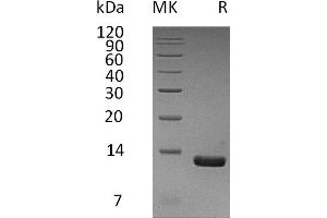SDS-PAGE (SDS) image for Chemokine (C-C Motif) Ligand 8 (CCL8) protein (His tag) (ABIN7455666)
