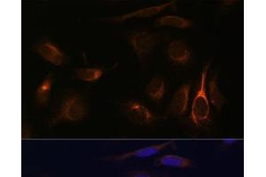 Immunofluorescence analysis of U-2 OS cells using VMP1 Polyclonal Antibody at dilution of 1:100 (40x lens). (VMP1 Antikörper)