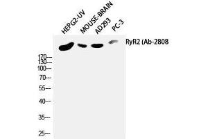 Western Blot analysis of HepG2-UV, Mouse brain, AD293T, PC-3 using RYR2 Polyclonal Antibody at dilution of 1:2000. (RYR2 Antikörper)