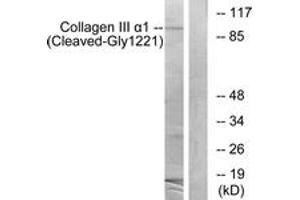 Western blot analysis of extracts from A549 cells, treated with etoposide 25uM 24h, using Collagen III alpha1 (Cleaved-Gly1221) Antibody. (COL3A1 Antikörper  (Cleaved-Gly1221))