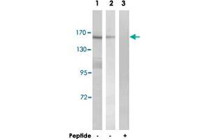 Western blot analysis of extracts from K-562 cells (Lane 1 and lane 3) and HT-29 cells (Lane 2), using MLH3 polyclonal antibody . (MLH3 Antikörper)
