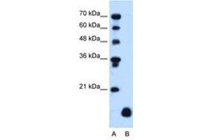 Image no. 1 for anti-Proteolipid Protein 2 (PLP2) (C-Term) antibody (ABIN205077) (PLP2 Antikörper  (C-Term))