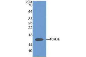 Western blot analysis of recombinant Mouse HPA. (HPSE Antikörper  (AA 280-412))
