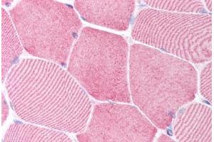 Human Skeletal Muscle (formalin-fixed, paraffin-embedded) stained with CASP6 antibody ABIN213918 at 5 ug/ml followed by biotinylated goat anti-rabbit IgG secondary antibody ABIN481713, alkaline phosphatase-streptavidin and chromogen. (Caspase 6 Antikörper  (N-Term))