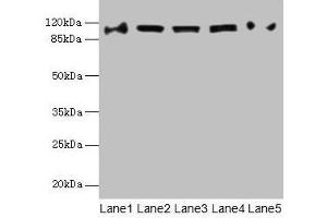 Western blot All lanes: COPB1 antibody at 1 μg/mL Lane 1: Hela whole cell lysate Lane 2: Jurkat whole cell lysate Lane 3: NIH/3T3 whole cell lysate Lane 4: Mouse liver tissue Lane 5: A549 whole cell lysate Secondary Goat polyclonal to rabbit IgG at 1/10000 dilution Predicted band size: 108 kDa Observed band size: 108 kDa (COPB1 Antikörper  (AA 2-200))