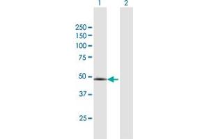 Western Blotting (WB) image for anti-Protein Phosphatase 2, Regulatory Subunit B'', gamma (PPP2R3C) (AA 1-453) antibody (ABIN527306)