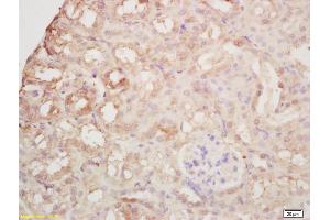 Formalin-fixed and paraffin embedded mouse kidney labeled with Rabbit Anti Arginase II Polyclonal Antibody, Unconjugated (ABIN1387473) at 1:200 followed by conjugation to the secondary antibody and DAB staining (ARG2 Antikörper  (AA 181-290))