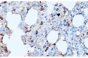 Immunohistochemistry of paraffin-embedded Rat lung using CXCR1 Polyclonal Antibody at dilution of 1:100 (40x lens). (CXCR1 Antikörper)