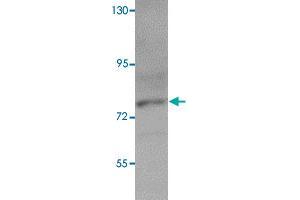 Western blot analysis of K-562 cells with PIAS3 polyclonal antibody  at 1 ug/mL dilution.