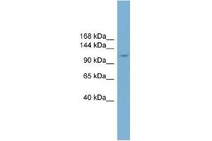 WB Suggested Anti-TRIM37 Antibody Titration:  0.